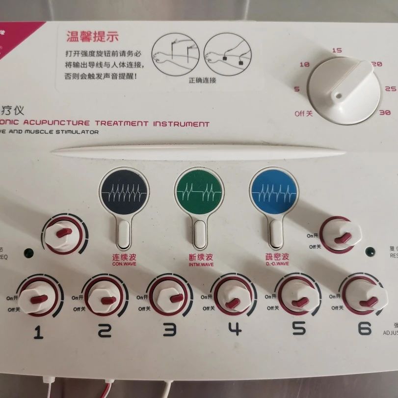 電子針療儀 - 