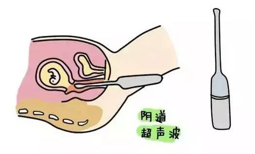 圖片3.png